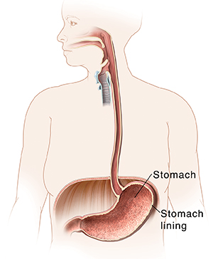 Outline of woman showing mouth, esophagus, and stomach.