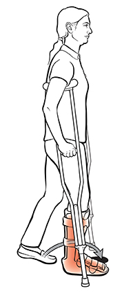 Side view of woman using crutches, stepping forward in between crutches with uninjured foot.