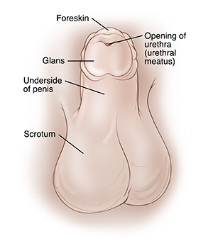 Child's penis with penis pointing up to show underside. Foreskin surrounds glans at top of penis. Scrotum is underneath penis. Opening of urethra is in normal location at center of glans.