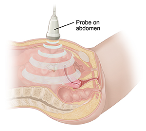 Cross section of female pelvis viewed from the side. Ultrasound transducer on lower abdomen.