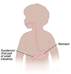 Outline of child showing stomach and duodenum.