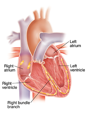 Cross section of heart showing right atrium, right ventricle, left atrium, left ventricle, and right bundle branch.