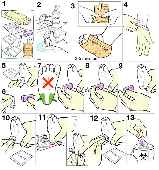 13 steps for doing a heel stick on a baby.