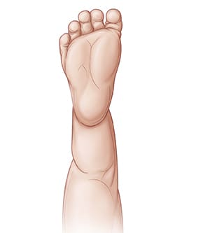 Back view of baby's leg showing bottom of foot.