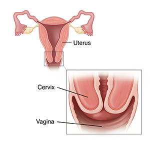 Cross section of uterus with inset showing closeup of vagina and cervix.