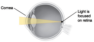 Cross section of eye showing light focusing on retina.