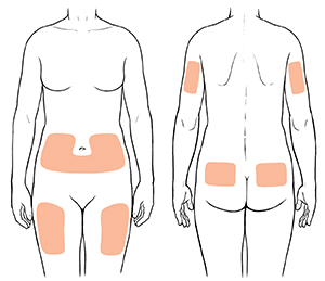 Human outlines showing injection sites on front and back of torso, front of thighs, and back of arms.