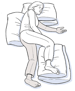 Woman lying on side affected by stroke with pillows supporting back, head, and unaffected leg.