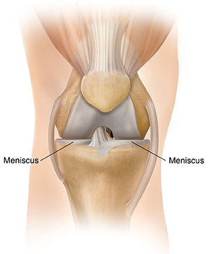 Front view of knee showing medial meniscus and lateral meniscus.