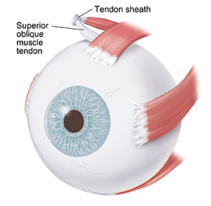 Three-quarter view of eye showing eye muscles.