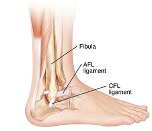 Side view of bones of lower leg and foot showing posterior talofibular ligament, calcaneofibular ligament, and anterior talofibular ligament. 