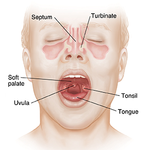 Front of face showing septum, turbinate, and open mouth with tonsil, tongue, uvula, and soft palate.