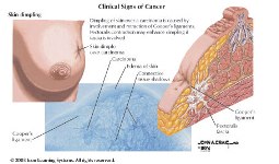 Image of clinical signs of cancer