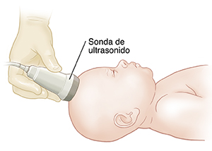 Mano con guante que sostiene la sonda de ecografía en la cabeza de un bebé.