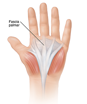 Vista de la palma de la mano, donde puede verse la fascia palmar.