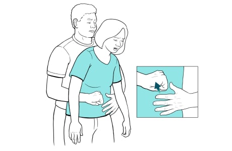 Hombre detrás de la mujer con los brazos alrededor de su cintura y detalle del puño y la otra mano preparada para cubrir el puño.