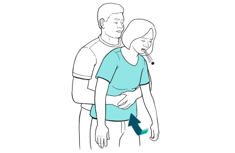 Hombre dando compresiones abdominales a mujer, mostrando objeto que sale de la boca.