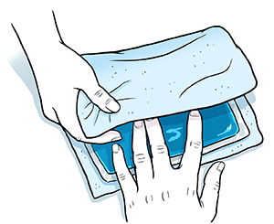Image of wrapping the cold source in a thin towel before using it.