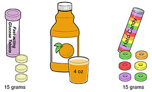 Examples of 15 grams of carbs, showing 3 glucose tablets, 4 ounces of juice, and 6 pieces of candy.