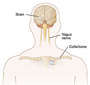Front view of man's head and chest showing brain and vagus nerves.