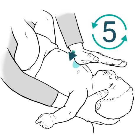 Person holding baby face-up on forearm and supporting baby's head with hand while pushing heel of other hand on baby's breastbone just below the nipple line.