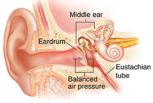 Cross section of ear showing eardrum, eustacian tube, and middle ear structures with balanced air pressure.