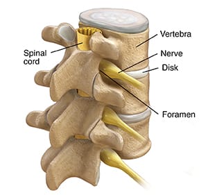 Three lumbar vertebrae, showing spinal cord in spinal column, nerves, discs, and foramen.