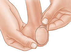 Closeup of hands checking vas during testicular self-exam.