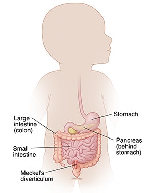 Digestive tract of baby, including stomach, pancreas, small intestine, and large intestine, showing  Meckel's diverticulum in small intestine.