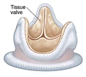 Biological heart valve.