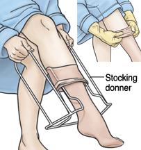Person using donner to put on compression stocking, and inset showing person using rubber gloves to help put on stockings.