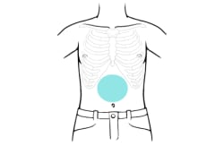 Child’s front torso with area just above belly button and below breastbone highlighted.